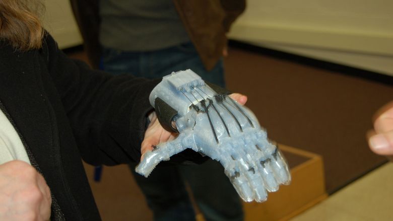 prosthetic hand